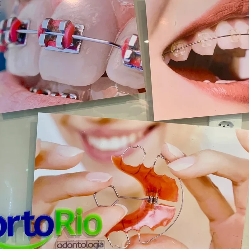 orto-rio-odontologia-dentista-em-madureira-29